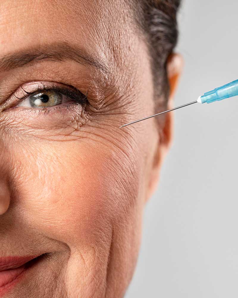 Glabellar Lines (Frown Lines / 11s) Botox — Rayhana Esthetics Pittsburgh PA